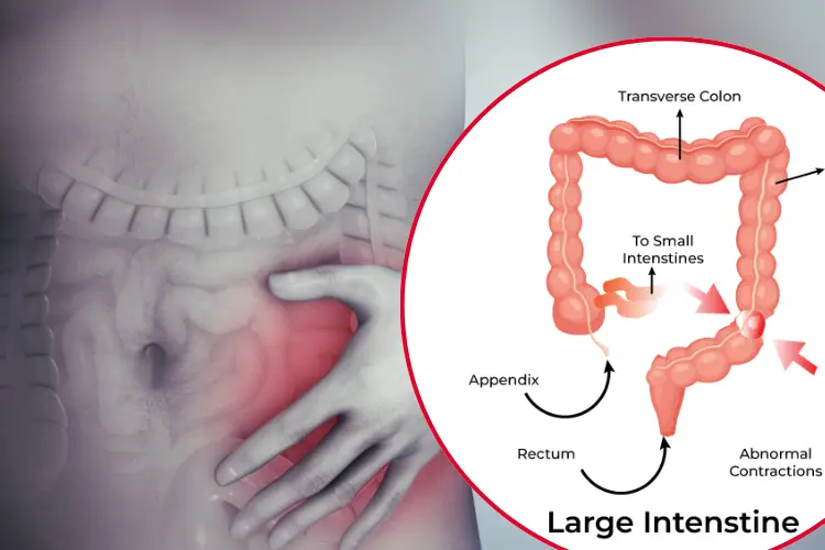 Do You Have IBS? Understanding and Managing Your Symptoms